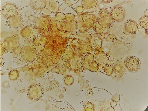 Pollen Grain In Urine